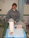 Tami's Australian Broken Leg Receives Yet Another Cast in Denver